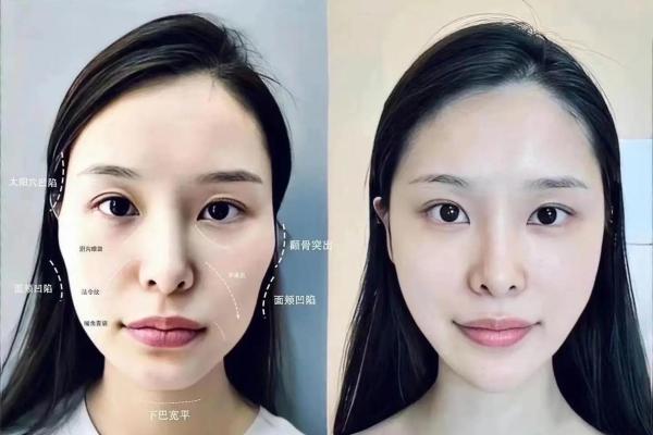 32颗牙女人的命运：解密牙齿与性格、命运的迷人关系