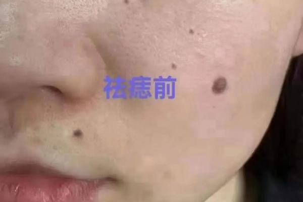 女人鼻翼有肉的命运解析：揭示财富与爱情的奥秘