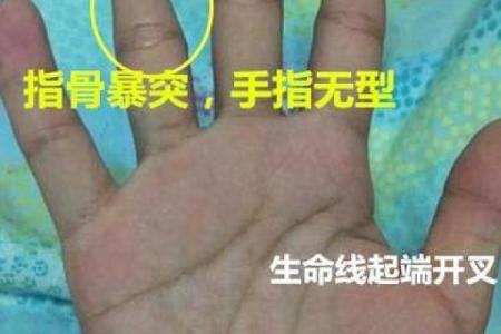 耳后之纹：探秘命格与命运的微妙关系