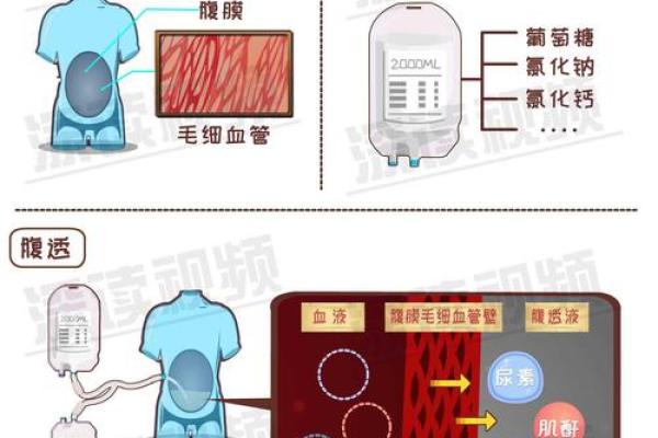 揭秘：哪些疾病需要换血续命？了解血液透析与造血干细胞移植！