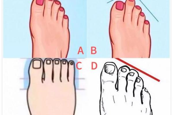 探秘脚纹:你脚上的纹路藏着富贵命的秘密! 探秘脚纹:你脚上的纹路藏着富贵命的秘密!